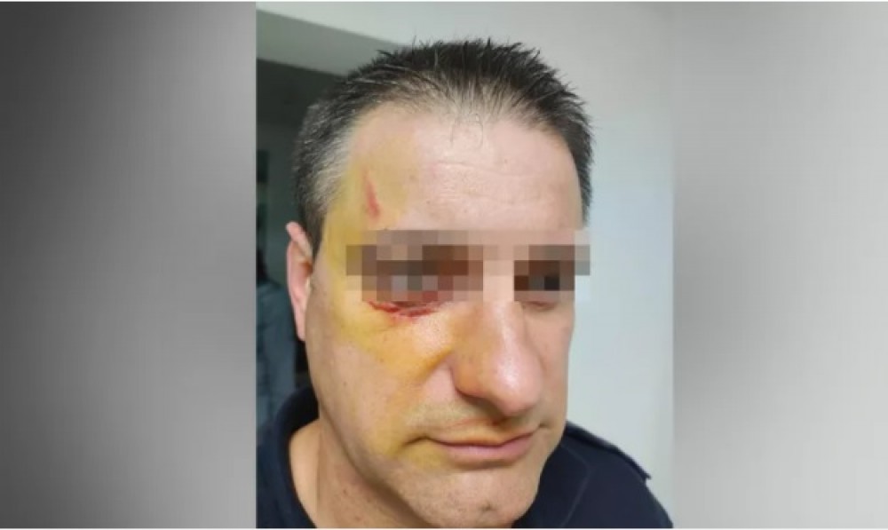 Polițist atacat de un refugiat într-un centru de cazare pentru imigranți. Ofițerul a avut nevoie de intervenția medicilor